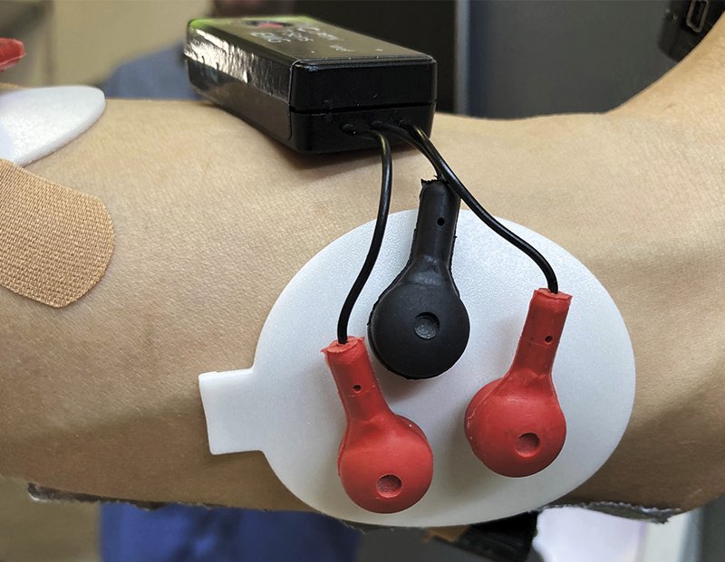 ein Arm mit Elektroden